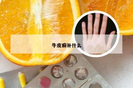 牛皮癣补什么