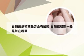 白颠疯病初期是否会有凹陷 白颠疯初期一般是长在哪里