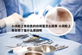 小孩脸上有白色的白斑是怎么回事 小孩脸上有白斑了是什么原因呢