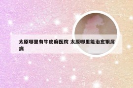 太原哪里有牛皮癣医院 太原哪里能治愈银屑病