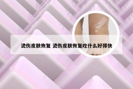 烫伤皮肤恢复 烫伤皮肤恢复吃什么好得快