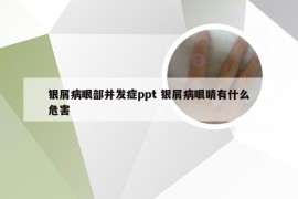 银屑病眼部并发症ppt 银屑病眼睛有什么危害