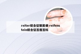 reiter综合征银屑病 reifenstein综合征百度百科