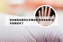 出生就有白斑可以不理会吗 出生有白斑 长大白斑也大了