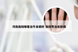 河南南阳哪里治牛皮癣好 南阳专治皮肤病