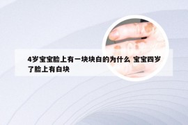 4岁宝宝脸上有一块块白的为什么 宝宝四岁了脸上有白块