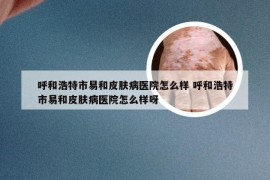 呼和浩特市易和皮肤病医院怎么样 呼和浩特市易和皮肤病医院怎么样呀