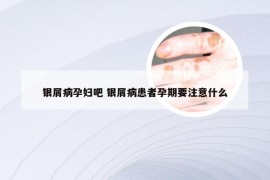 银屑病孕妇吧 银屑病患者孕期要注意什么