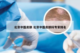 北京中医皮肤 北京中医皮肤科专家排名