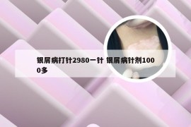 银屑病打针2980一针 银屑病针剂1000多