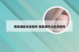 银屑病能吃凤梨吗 银屑病可以吃凤梨吗