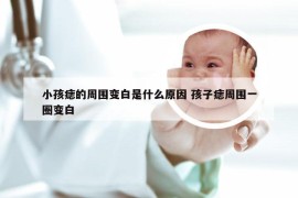 小孩痣的周围变白是什么原因 孩子痣周围一圈变白