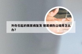 外伤引起的银屑病复发 银屑病伤口增厚怎么办?