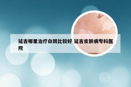 延吉哪里治疗白斑比较好 延吉皮肤病专科医院