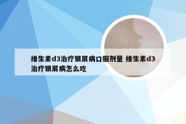 维生素d3治疗银屑病口服剂量 维生素d3治疗银屑病怎么吃