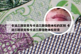 卡泊三醇软膏与卡泊三醇倍他米松的区别 卡泊三醇软膏和卡泊三醇倍他米松软膏