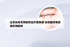 北京协和生物制剂治疗银屑病 协和医院银屑病生物制剂