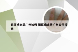 银屑病定居广州如何 银屑病定居广州如何报销