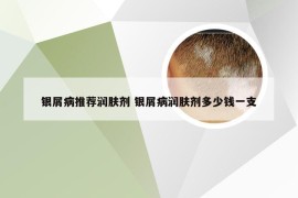 银屑病推荐润肤剂 银屑病润肤剂多少钱一支