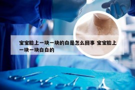 宝宝脸上一块一块的白是怎么回事 宝宝脸上一块一块白白的