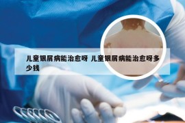 儿童银屑病能治愈呀 儿童银屑病能治愈呀多少钱