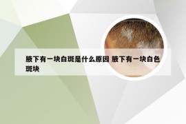 腋下有一块白斑是什么原因 腋下有一块白色斑块