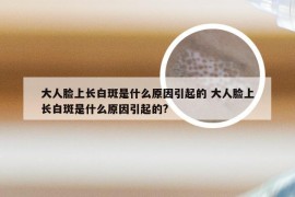 大人脸上长白斑是什么原因引起的 大人脸上长白斑是什么原因引起的?