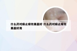什么药对癣止痒效果最好 什么药对癣止痒效果最好用