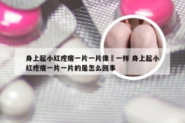 身上起小红疙瘩一片一片像廯一样 身上起小红疙瘩一片一片的是怎么回事