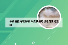 牛皮癣能吃花生嘛 牛皮肤癣可以吃花生毛豆吗
