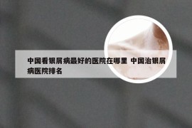 中国看银屑病最好的医院在哪里 中国治银屑病医院排名