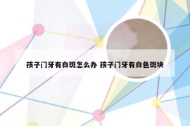 孩子门牙有白斑怎么办 孩子门牙有白色斑块