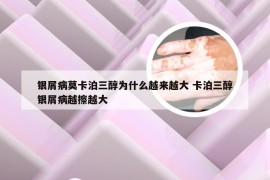 银屑病莫卡泊三醇为什么越来越大 卡泊三醇银屑病越擦越大