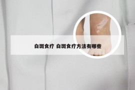 白斑食疗 白斑食疗方法有哪些