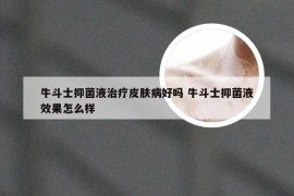 牛斗士抑菌液治疗皮肤病好吗 牛斗士抑菌液效果怎么样