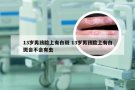 13岁男孩脸上有白斑 13岁男孩脸上有白斑会不会有虫