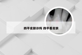 四平皮肤诊所 四平看皮肤
