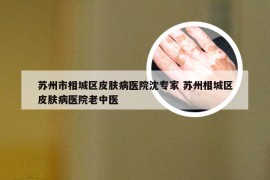 苏州市相城区皮肤病医院沈专家 苏州相城区皮肤病医院老中医