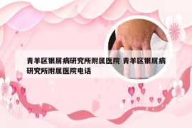 青羊区银屑病研究所附属医院 青羊区银屑病研究所附属医院电话