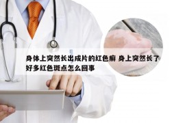 身体上突然长出成片的红色癣 身上突然长了好多红色斑点怎么回事