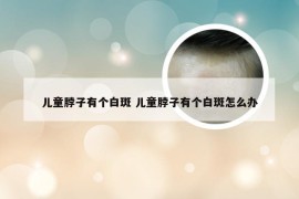 儿童脖子有个白斑 儿童脖子有个白斑怎么办