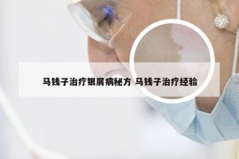 马钱子治疗银屑病秘方 马钱子治疗经验
