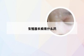 生殖器长癣用什么药