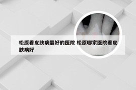 松原看皮肤病最好的医院 松原哪家医院看皮肤病好