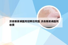 济南银屑病医院招聘住院医 济南银屑病医院收费