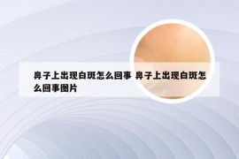 鼻子上出现白斑怎么回事 鼻子上出现白斑怎么回事图片