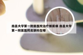南昌大学第一附属医院治疗银屑病 南昌大学第一附属医院皮肤科在哪
