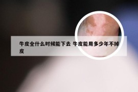 牛皮全什么时候能下去 牛皮能用多少年不掉皮