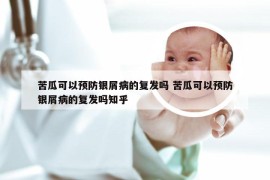 苦瓜可以预防银屑病的复发吗 苦瓜可以预防银屑病的复发吗知乎