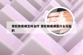 掌跎脓疱病怎样治疗 掌跎脓疱病是什么引起的